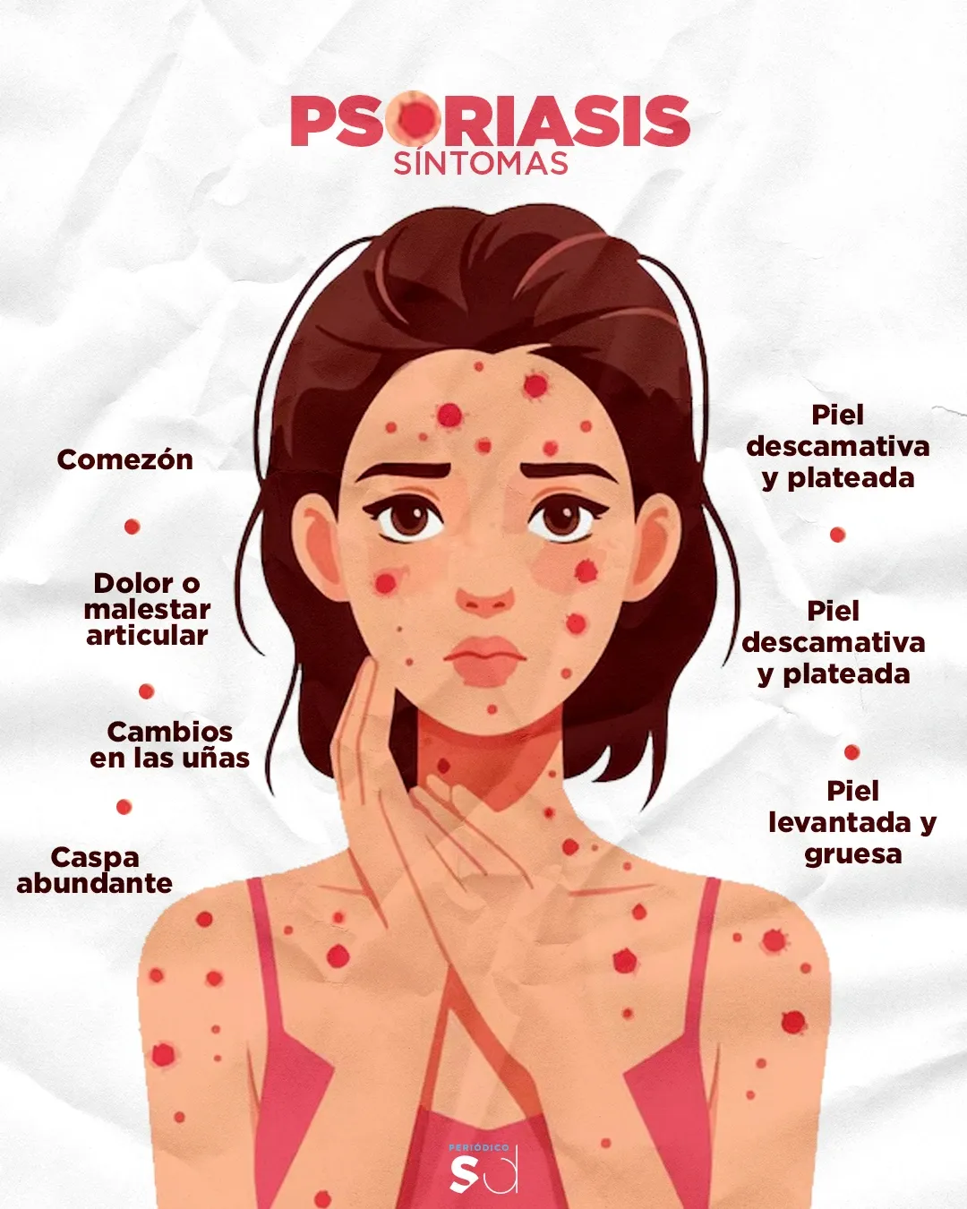 Psoriasis y piel: hábitos y nutrición de apoyo